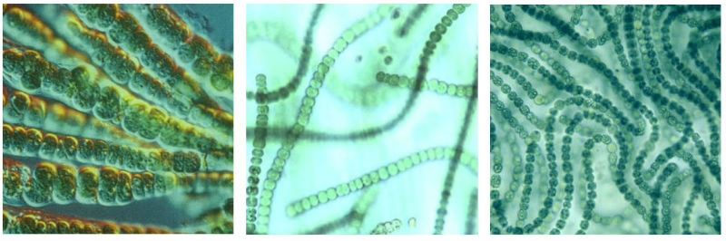 Microscopic Blue Green Algae and Swimming